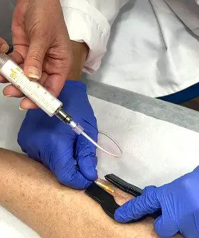 Microespuma